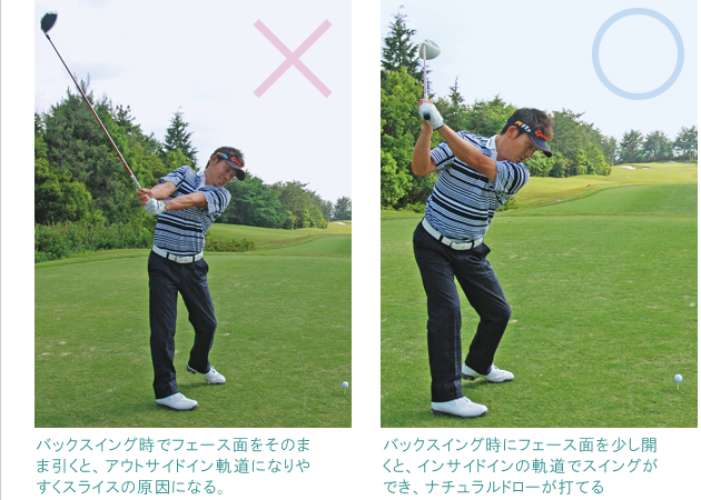 03.スライス矯正